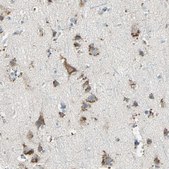 Anti-CTSD antibody produced in rabbit Prestige Antibodies&#174; Powered by Atlas Antibodies, affinity isolated antibody, buffered aqueous glycerol solution