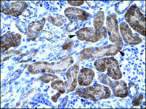 Anti-TRIM31 antibody produced in rabbit affinity isolated antibody