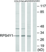 Anti-RPS4Y1 antibody produced in rabbit affinity isolated antibody
