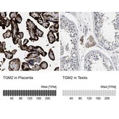 Anti-TGM2 antibody produced in rabbit Prestige Antibodies&#174; Powered by Atlas Antibodies, affinity isolated antibody, buffered aqueous glycerol solution