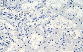 Anti-EBP/NHERF-1 Antibody, clone 1G10 ZooMAb&#174; Rabbit Monoclonal recombinant, expressed in HEK 293 cells