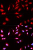Anti- PDPK1 antibody produced in rabbit