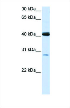 Anti-GCDH antibody produced in rabbit affinity isolated antibody