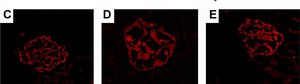 Anti-Podocin antibody produced in rabbit affinity isolated antibody, buffered aqueous solution