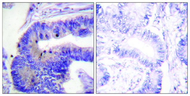 Anti-PDE4D antibody produced in rabbit affinity isolated antibody