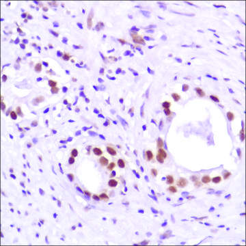 Anti-Androgen Receptor (C-term) antibody, Rabbit monoclonal recombinant, expressed in proprietary host, clone SP224, affinity isolated antibody