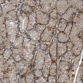 Anti-UTRN antibody produced in rabbit Prestige Antibodies&#174; Powered by Atlas Antibodies, affinity isolated antibody, buffered aqueous glycerol solution
