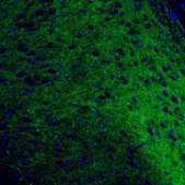 Anti-OPRM1 antibody produced in rabbit Prestige Antibodies&#174; Powered by Atlas Antibodies, affinity isolated antibody, buffered aqueous glycerol solution