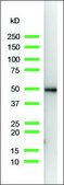 Anti-Keratin 14 antibody, Rabbit monoclonal clone SP53, recombinant, expressed in proprietary host, affinity isolated antibody