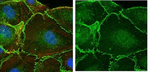 Anti-&#946;-Catenin Antibody Upstate&#174;, from rabbit