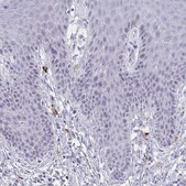 Anti-MS4A2 antibody produced in rabbit Prestige Antibodies&#174; Powered by Atlas Antibodies, affinity isolated antibody, buffered aqueous glycerol solution