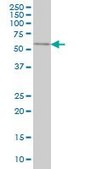 Monoclonal Anti-SPAG6 antibody produced in mouse clone 3E3, purified immunoglobulin, buffered aqueous solution