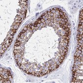 Anti-CDH2 antibody produced in rabbit Prestige Antibodies&#174; Powered by Atlas Antibodies, affinity isolated antibody, buffered aqueous glycerol solution