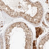 Anti-INTS11 antibody produced in rabbit Prestige Antibodies&#174; Powered by Atlas Antibodies, affinity isolated antibody, buffered aqueous glycerol solution