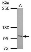 Anti-ENPP2 antibody produced in rabbit affinity isolated antibody, buffered aqueous solution