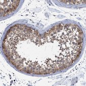 Anti-FHOD3 antibody produced in rabbit Prestige Antibodies&#174; Powered by Atlas Antibodies, affinity isolated antibody, buffered aqueous glycerol solution, Ab1