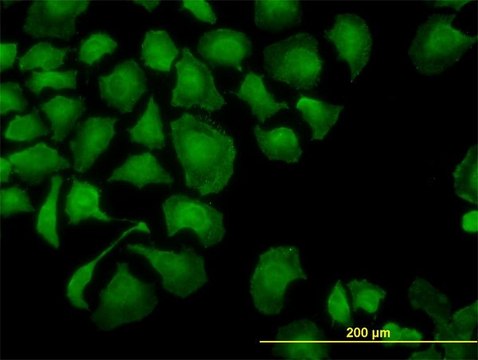 Monoclonal Anti-TROVE2 antibody produced in mouse clone 1F2, purified immunoglobulin, buffered aqueous solution