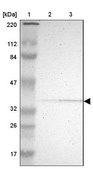 Anti-PDLIM2 antibody produced in rabbit Prestige Antibodies&#174; Powered by Atlas Antibodies, affinity isolated antibody, buffered aqueous glycerol solution