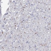 Anti-NRAP antibody produced in rabbit Prestige Antibodies&#174; Powered by Atlas Antibodies, affinity isolated antibody, buffered aqueous glycerol solution