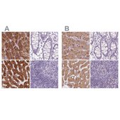 Anti-EPHX1 antibody produced in rabbit Prestige Antibodies&#174; Powered by Atlas Antibodies, affinity isolated antibody, buffered aqueous glycerol solution