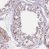 Anti-IFIT1 antibody produced in rabbit Prestige Antibodies&#174; Powered by Atlas Antibodies, affinity isolated antibody, buffered aqueous glycerol solution