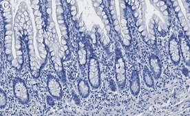 Anti-Vitamin D3 Receptor Antibody, clone 1M19 ZooMAb&#174; Rabbit Monoclonal recombinant, expressed in HEK 293 cells