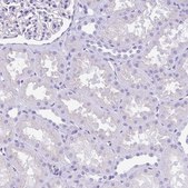 Anti-IAPP antibody produced in rabbit Prestige Antibodies&#174; Powered by Atlas Antibodies, affinity isolated antibody, buffered aqueous glycerol solution