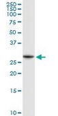 Anti-NQO1 antibody produced in rabbit purified immunoglobulin, buffered aqueous solution