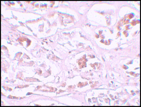 Anti-ALKBH2 antibody produced in rabbit affinity isolated antibody, buffered aqueous solution