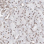 Anti-ZNF638 antibody produced in rabbit Prestige Antibodies&#174; Powered by Atlas Antibodies, affinity isolated antibody, buffered aqueous glycerol solution