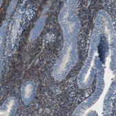 Anti-ALDH1A2 antibody produced in rabbit Prestige Antibodies&#174; Powered by Atlas Antibodies, affinity isolated antibody, buffered aqueous glycerol solution