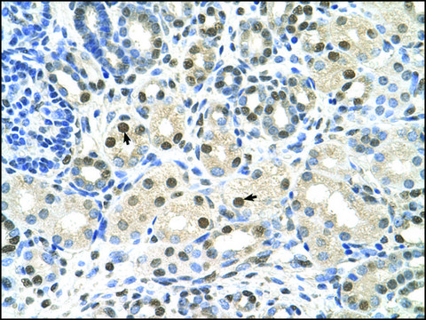 Anti-CACNB1 (AB2) antibody produced in rabbit affinity isolated antibody