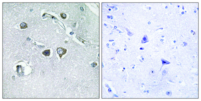 Anti-Collagen XI &#945;2 antibody produced in rabbit affinity isolated antibody