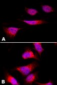 Anti-Protein Disulfide Isomerase (DL-11) antibody produced in rabbit affinity isolated antibody, buffered aqueous solution