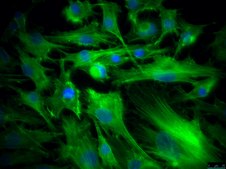 OSUMMER.8 Mouse NRAS-Mutant Melanoma Cell Line