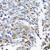 Anti-PGP9.5/UCHL1 antibody produced in rabbit