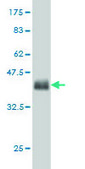 Monoclonal Anti-GLUL, (C-terminal) antibody produced in mouse clone 3B6, purified immunoglobulin, buffered aqueous solution