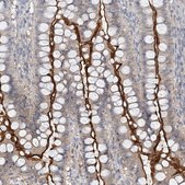 Anti-MAT2B antibody produced in rabbit Prestige Antibodies&#174; Powered by Atlas Antibodies, affinity isolated antibody, buffered aqueous glycerol solution