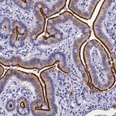 Anti-ACE2 antibody produced in rabbit Prestige Antibodies&#174; Powered by Atlas Antibodies, affinity isolated antibody, buffered aqueous glycerol solution