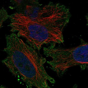 Anti-Kcnv1 Antibody Produced In Rabbit Prestige Antibodies&#174; Powered by Atlas Antibodies, affinity isolated antibody, buffered aqueous glycerol solution