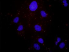 Anti-HGF antibody produced in rabbit purified immunoglobulin, buffered aqueous solution