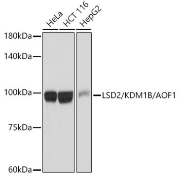 Anti-LSD2/KDM1B/AOF1 Antibody, clone 5M3W2, Rabbit Monoclonal