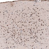 Monoclonal Anti-POU3F2 antibody produced in mouse Prestige Antibodies&#174; Powered by Atlas Antibodies, clone CL6232, purified immunoglobulin, buffered aqueous glycerol solution