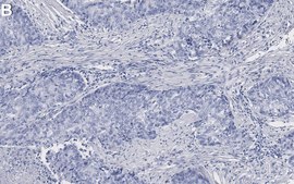 Anti-Caldesmon Antibody, clone 1E8 ZooMAb&#174; Rabbit Monoclonal recombinant, expressed in HEK 293 cells