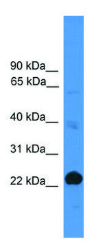 Anti-CD8A antibody produced in rabbit affinity isolated antibody