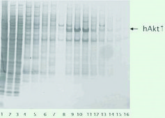 cOmplete&#8482;, EDTA-free Protease Inhibitor Cocktail Tablets provided in glass vials