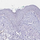 Anti-FASLG antibody produced in rabbit Prestige Antibodies&#174; Powered by Atlas Antibodies, affinity isolated antibody, buffered aqueous glycerol solution