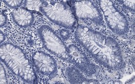 Anti-Na+/K+ ATPase &#945;1 Antibody, clone 2M18 ZooMAb&#174; Rabbit Monoclonal recombinant, expressed in HEK 293 cells