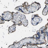 Anti-MC4R antibody produced in rabbit Prestige Antibodies&#174; Powered by Atlas Antibodies, affinity isolated antibody, buffered aqueous glycerol solution