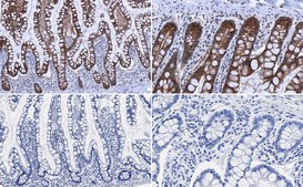 Anti-E-Cadherin Antibody serum, Upstate&#174;